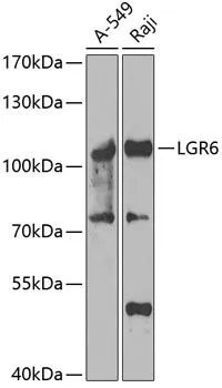WB analysis of variuos cell lysates using GTX03496 LGR6 antibody. Dilution : 1:1000 Loading : 25 microg per lane