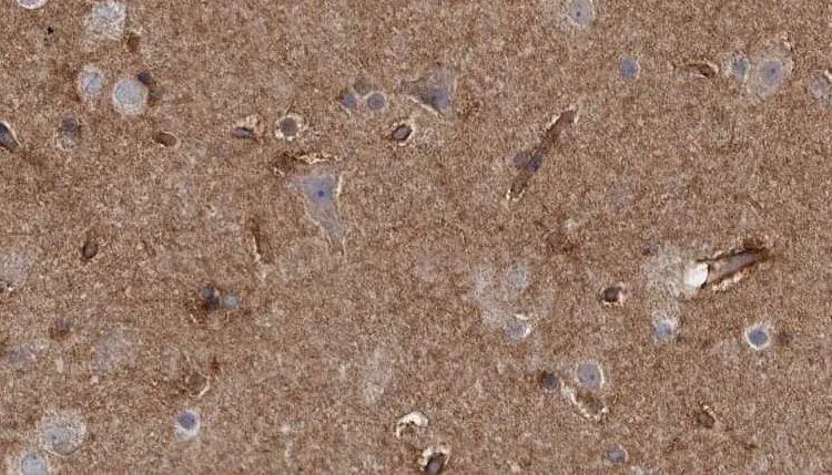 IHC-P analysis of rat brain tissue using GTX03587 Doublecortin (phospho Ser335) antibody. Antigen retireval : Heat mediated antigen retrieval step in citrate buffer was performed. Dilution : 1:100