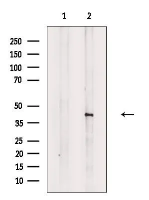 WB analysis of mouse lung tissue lysate using GTX03587 Doublecortin (phospho Ser335) antibody. The lane on the left was treated with the antigen-specific peptide.
