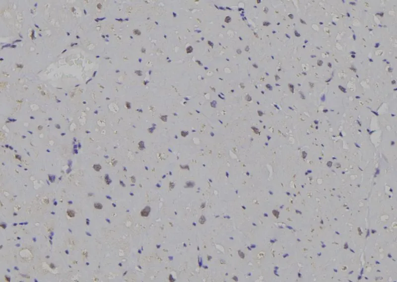 IHC-P analysis of human heart tissue using GTX03588 14-3-3 zeta antibody. Antigen retireval : Heat mediated antigen retrieval step in citrate buffer was performed. Dilution : 1:100 IHC-P analysis of human heart tissue using GTX03588 14-3-3 zeta antibody. Antigen retireval : Heat mediated antigen retrieval step in citrate buffer was performed. Dilution : 1:100