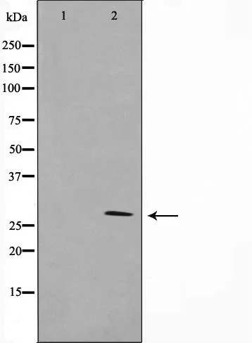 WB analysis of K562 cell lysate using GTX03588 14-3-3 zeta antibody. The lane on the left was treated with the antigen-specific peptide.