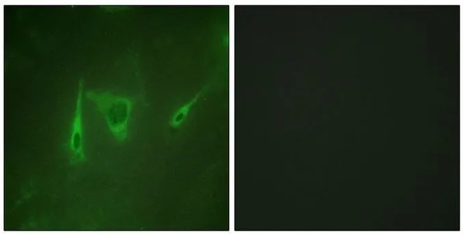 ICC/IF analysis of NIH-3T3 cells using GTX03589 14-3-3 zeta antibody. The picture on the right is blocked with the synthesized peptide. ICC/IF analysis of NIH-3T3 cells using GTX03589 14-3-3 zeta antibody. The picture on the right is blocked with the synthesized peptide.