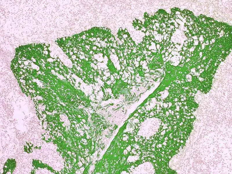 IHC-P analysis of human tonsil tissue using GTX01662 Cytokeratin 7 + 8 antibody [CAM5.2] (ready-to-use) with GTX03612 Tissue Glue.