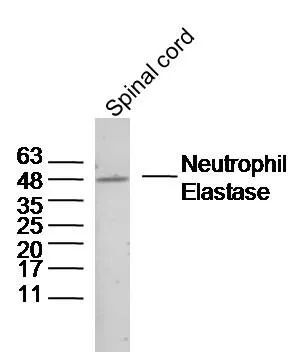 WB analysis of mouse spinal cord lysates using GTX03641 Neutrophil elastase antibody. Dilution : 1:300