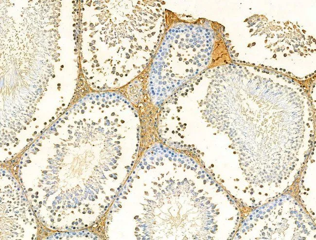 IHC-P analysis of rat testis tissue using GTX03644 Galectin 9 antibody. Antigen retireval : Heat mediated antigen retrieval step in citrate buffer was performed Dilution : 1:100