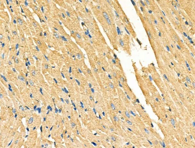 IHC-P analysis of rat heart tissue using GTX03644 Galectin 9 antibody. Antigen retireval : Heat mediated antigen retrieval step in citrate buffer was performed Dilution : 1:100
