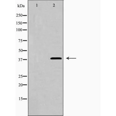 WB analysis of HepG2 cell lysate using GTX03644 Galectin 9 antibody. The lane on the left was treated with the antigen-specific peptide.