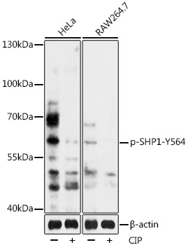 WB analysis of HeLa and Raw264.7 cell lysates treated by CIP at 37oC for 1 hour using GTX03665 SHP1 (phospho Tyr564) antibody. The signal is developed using an Enhanced Chemiluminescent detection (ECL) kit. Dilution : 1:2000 Loading : 25microg per lanes WB analysis of HeLa and Raw264.7 cell lysates treated by CIP at 37oC for 1 hour using GTX03665 SHP1 (phospho Tyr564) antibody. The signal is developed using an Enhanced Chemiluminescent detection (ECL) kit. Dilution : 1:2000 Loading : 25microg per lanes