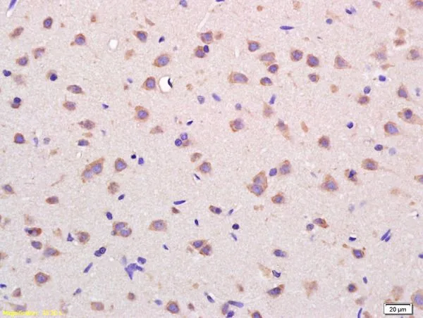 IHC-P analysis of rat brain tissue using GTX03668 VDAC1 antibody. Dilution : 1:200 IHC-P analysis of rat brain tissue using GTX03668 VDAC1 antibody. Dilution : 1:200