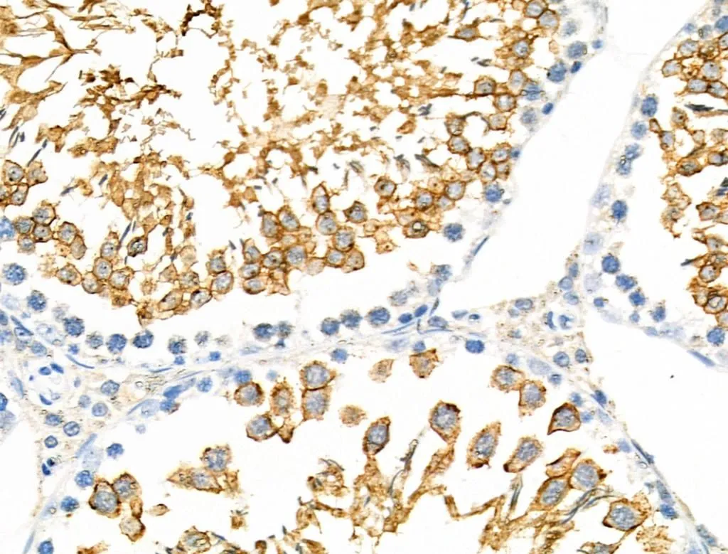 IHC-P analysis of rat testis tissue using GTX03675 RANBP17 Antibody. Antigen retireval : Heat mediated antigen retrieval step in citrate buffer was performed Dilution : 1:100 IHC-P analysis of rat testis tissue using GTX03675 RANBP17 Antibody. Antigen retireval : Heat mediated antigen retrieval step in citrate buffer was performed Dilution : 1:100