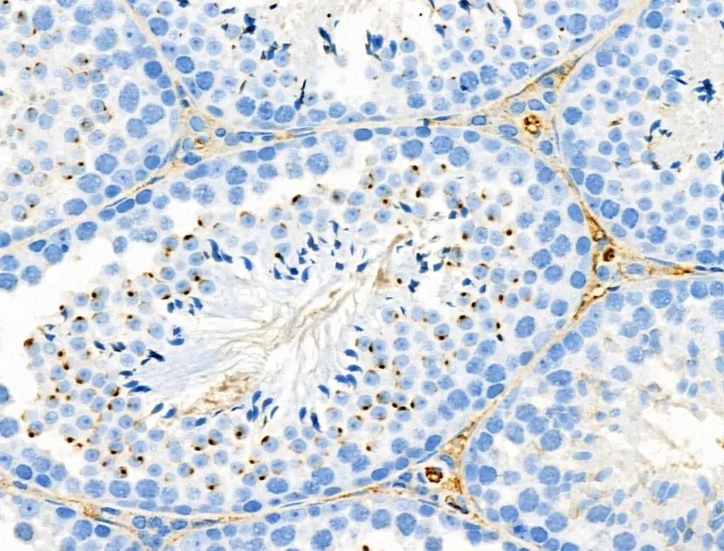 IHC-P analysis of mouse testis tissue using GTX03675 RANBP17 Antibody. Antigen retireval : Heat mediated antigen retrieval step in citrate buffer was performed Dilution : 1:100
