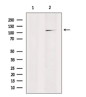 WB analysis of HepG2 lysate using GTX03675 RANBP17 Antibody. Lane 1 was treated with the blocking peptide.