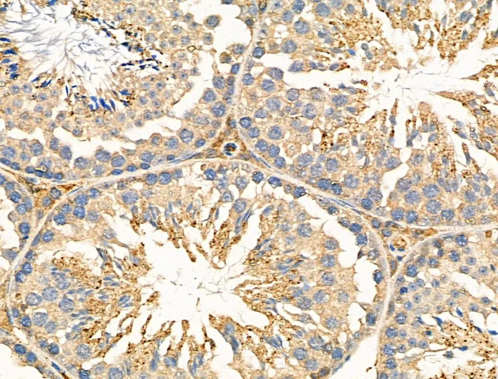 IHC-P analysis of mouse testis tissue using GTX03680 NEGR1 antibody. Dilution : 1:100 Antigen retrieval : Heat mediated antigen retrieval was performed in citrate buffer. IHC-P analysis of mouse testis tissue using GTX03680 NEGR1 antibody. Dilution : 1:100 Antigen retrieval : Heat mediated antigen retrieval was performed in citrate buffer.