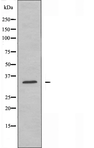 WB analysis of COLO cell lysates using GTX03680 NEGR1 antibody.