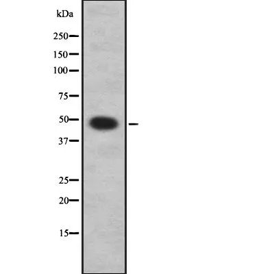 WB analysis of Jurkat cell lysates using GTX03690 ARRDC1 antibody.