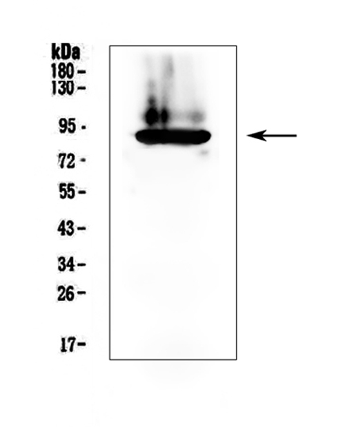 WB analysis of human plasma lysate using GTX03694 Prothrombin antibody. Dilution : 0.5 microg/ml Loading: 50 microg per lane