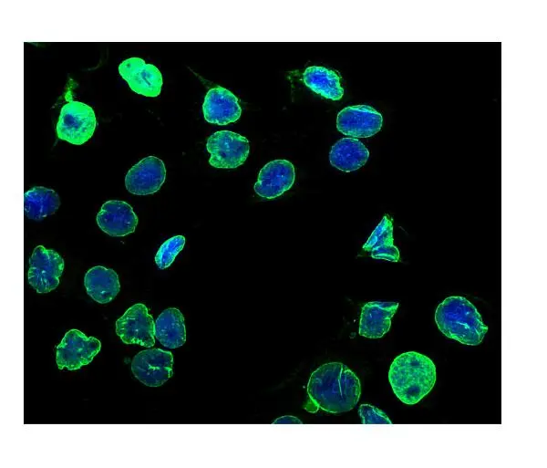 ICC/IF analysis of U2OS cells using GTX03695 Lamin B1 antibody. Enzyme antigen retrieval was performed using IHC enzyme antigen retrieval reagent for 15 mins. Dilution : 2 microg/mL