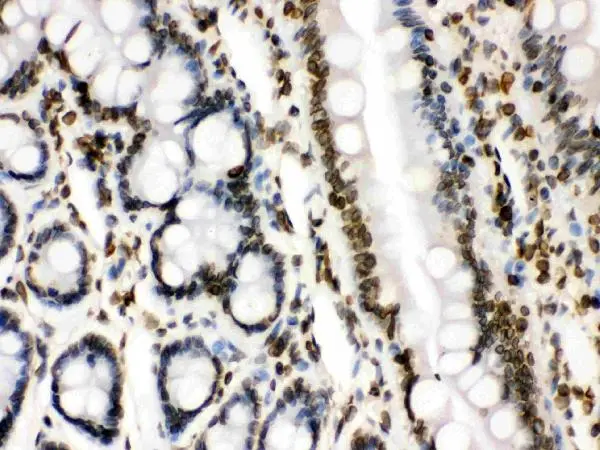 IHC-P analysis of rat intestine tissue using GTX03695 Lamin B1 antibody. Dilution : 1 microg/ml Antigen retrieval : Heat mediated antigen retrieval was performed in citrate buffer (pH6, epitope retrieval solution) for 20 mins