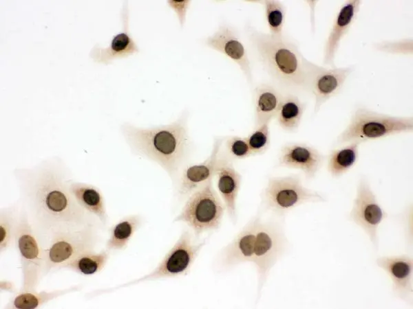 ICC/IF analysis of A549 cells using GTX03695 Lamin B1 antibody. Dilution : 1 microg/ml Antigen retrieval : Enzyme antigen retrieval reagent