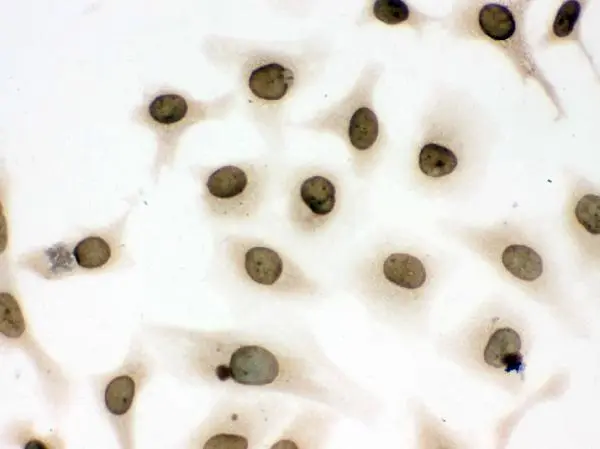 ICC/IF analysis of HeLa cells using GTX03695 Lamin B1 antibody. Dilution : 1 microg/ml Antigen retrieval : Enzyme antigen retrieval reagent