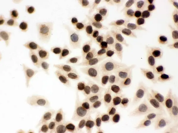 ICC/IF analysis of SMMC-7721 cells using GTX03695 Lamin B1 antibody. Dilution : 1 microg/ml Antigen retrieval : Enzyme antigen retrieval reagent