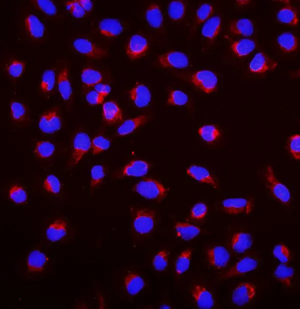 ICC/IF analysis of U2OS cells using GTX03696 SGK1 antibody. Enzyme antigen retrieval was performed using IHC enzyme antigen retrieval reagent for 15 mins. Dilution : 2 microg/mL