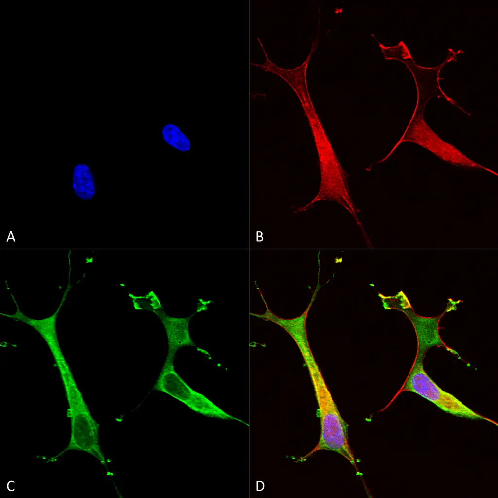 ICC/IF analysis of 4%PFA-fixed SH-SY5Y using GTX03698 ATP7b antibody [S62-29]. Green : Primary antibody Blue : Hoechst nuclear stain Red : F-Actin Dilution : 1:100