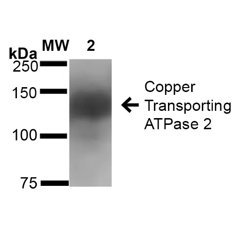 WB analysis of rat brain lysate using GTX03698 ATP7b antibody [S62-29]. Dilution : 1:1000 Loading : 20 microg per lane