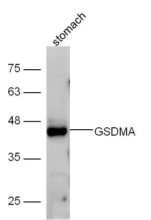 WB analysis of mouse stomach tissue lysates using GTX03715 GSDMA antibody. Dilution : 1:300