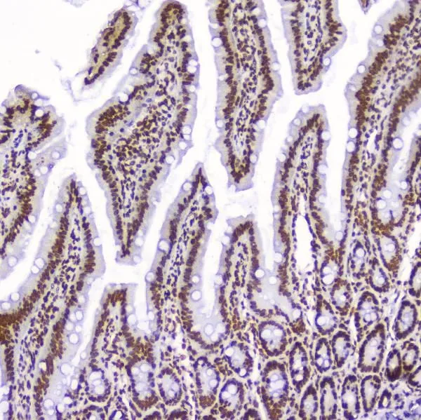 IHC-P analysis of rat small intestine tissue using GTX03719 AHR antibody. Antigen retrieval : Heat mediated antigen retrieval was performed in citrate buffer (pH6, epitope retrieval solution) for 20 mins Dilution : 2microg/ml
