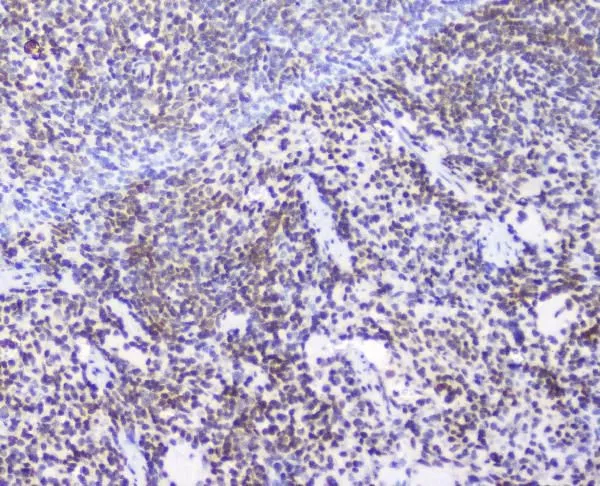 IHC-P analysis of rat spleen tissue using GTX03719 AHR antibody. Antigen retrieval : Heat mediated antigen retrieval was performed in citrate buffer (pH6, epitope retrieval solution) for 20 mins Dilution : 2microg/ml
