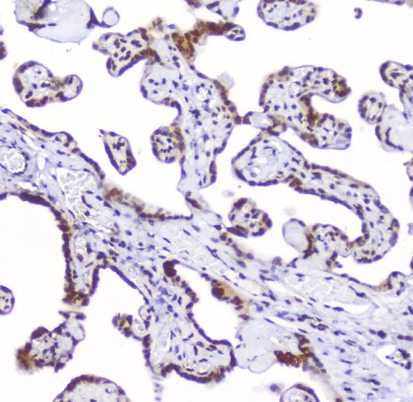 IHC-P analysis of human placenta tissue using GTX03719 AHR antibody. Antigen retrieval : Heat mediated antigen retrieval was performed in citrate buffer (pH6, epitope retrieval solution) for 20 mins Dilution : 2microg/ml