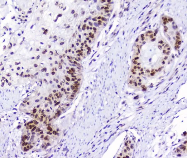 IHC-P analysis of human oesophagus tissue using GTX03719 AHR antibody. Antigen retrieval : Heat mediated antigen retrieval was performed in citrate buffer (pH6, epitope retrieval solution) for 20 mins Dilution : 2microg/ml
