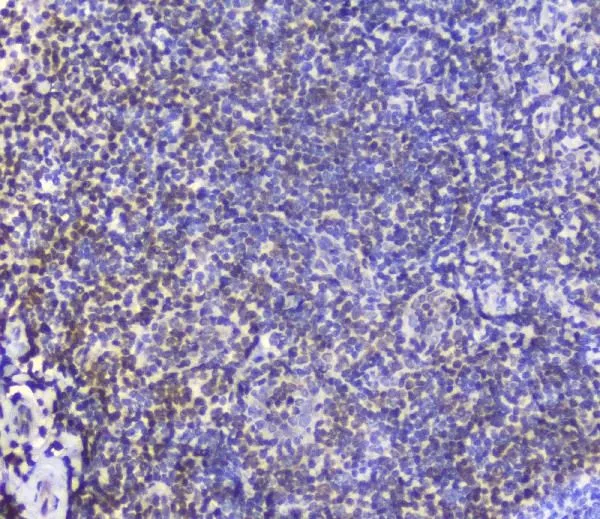 IHC-P analysis of human tonsil tissue using GTX03719 AHR antibody. Antigen retrieval : Heat mediated antigen retrieval was performed in citrate buffer (pH6, epitope retrieval solution) for 20 mins Dilution : 2microg/ml