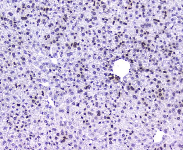 IHC-P analysis of mouse liver tissue using GTX03719 AHR antibody. Antigen retrieval : Heat mediated antigen retrieval was performed in citrate buffer (pH6, epitope retrieval solution) for 20 mins Dilution : 2microg/ml