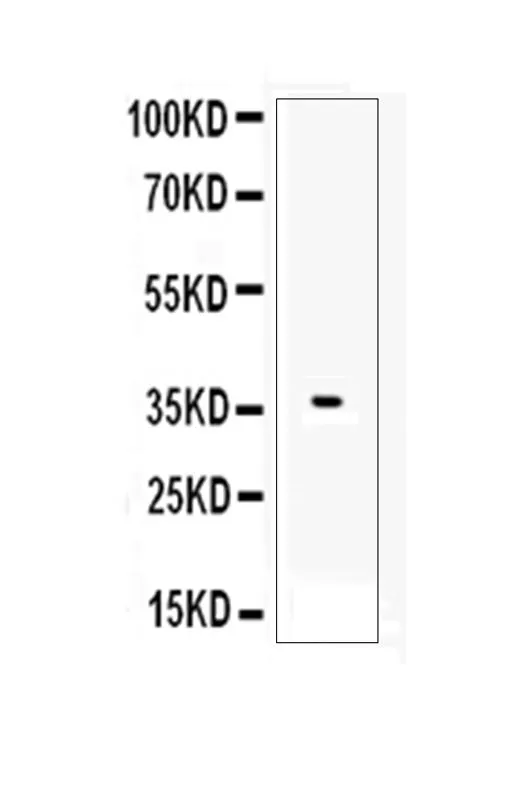 WB analysis of recombinant human AHR protein using GTX03719 AHR antibody. Dilution : 0.5 microg/mL Loading : 1 ng