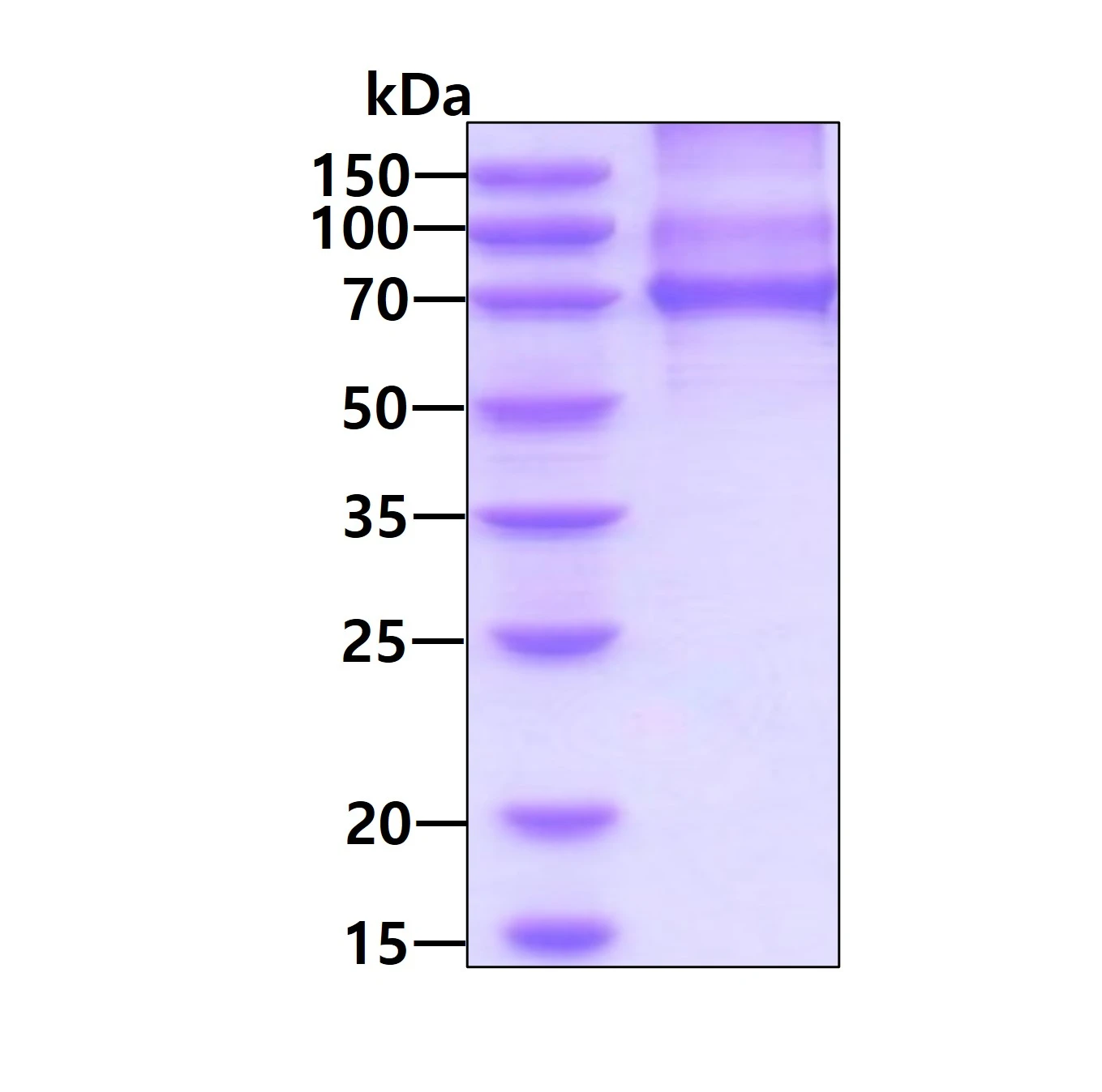 SDS-PAGE of GTX03726-pro Human PKC iota protein, His tag.