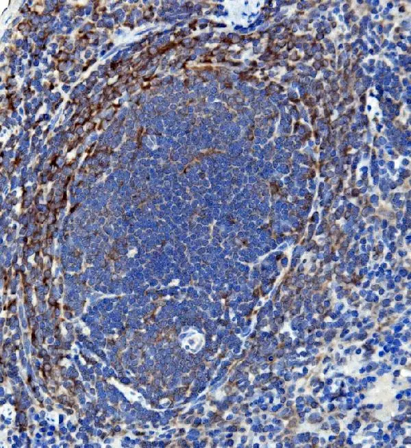 IHC-P analysis of rat spleen tissue using GTX03734 IL18 antibody. Antigen retrieval : Heat mediated antigen retrieval was performed in EDTA buffer (pH8.0, epitope retrieval solution) Dilution : 2microg/ml