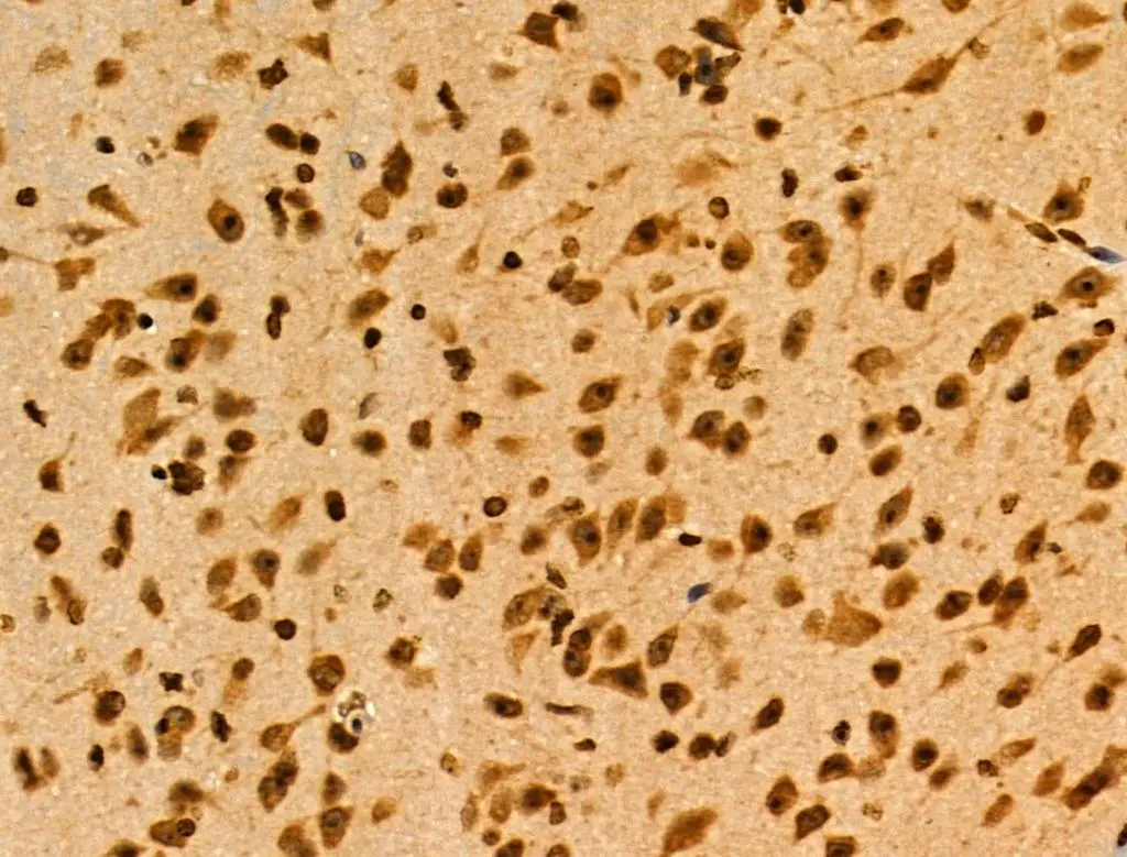 IHC-P analysis mouse brain tissue using GTX03745 MAP4K3 antibody. Antigen retrieval : Heat mediated citrate buffer Dilution : 1:100