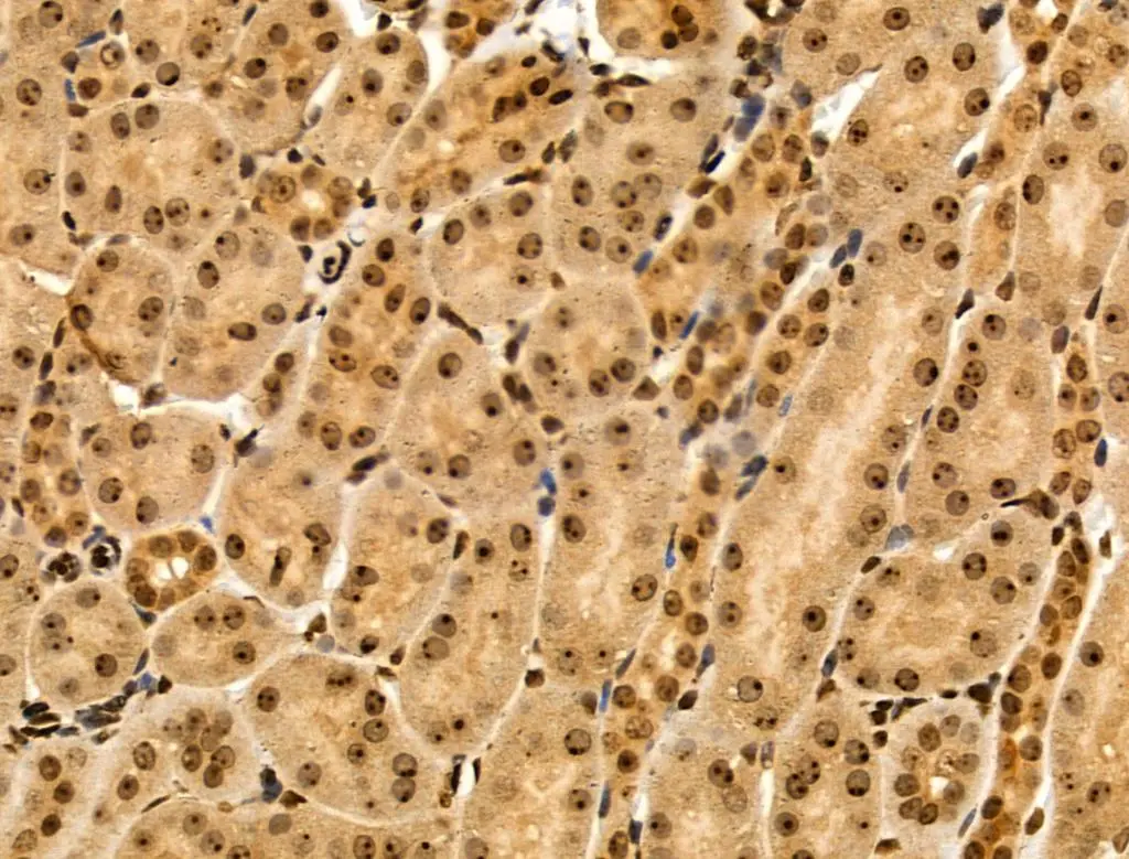 IHC-P analysis mouse kidney tissue using GTX03745 MAP4K3 antibody. Antigen retrieval : Heat mediated citrate buffer Dilution : 1:100