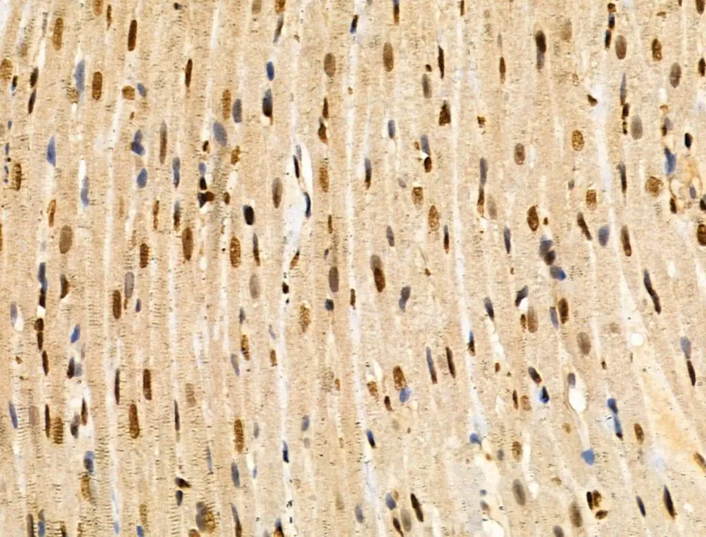 IHC-P analysis rat heart tissue using GTX03745 MAP4K3 antibody. Antigen retrieval : Heat mediated citrate buffer Dilution : 1:100