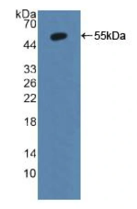 WB analysis of GTX03782-pro Mouse Annexin II protein.