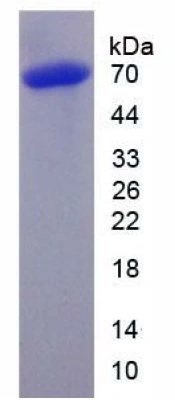 SDS-PAGE analysis of GTX03797-pro Rat CTGF protein, His and GST tag (active).