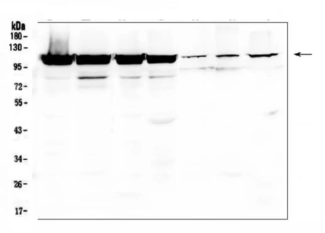 WB analysis of various sample lysates using GTX03806 LONP1 antibody. Lane 1 : K562 cells Lane 2 : U87-MG cells Lane 3 : PC-3 cells Lane 4 : A549 cells Lane 5 : Mouse liver tissue Lane 6 : Mouse kidney tissue Lane 7 : SP20 cells Dilution : 0.5 microg/mL Loading : 50 microg per lane