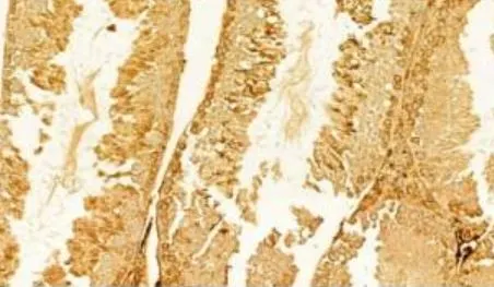 IHC-P analysis of mouse testis tissue using GTX03810 CXCL1 / GRO alpha antibody. Antigen retireval : Heat mediated antigen retrieval step in citrate buffer was performed. Dilution : 1:100 IHC-P analysis of mouse testis tissue using GTX03810 CXCL1 / GRO alpha antibody. Antigen retireval : Heat mediated antigen retrieval step in citrate buffer was performed. Dilution : 1:100