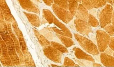 IHC-P analysis of rat skin tissue using GTX03810 CXCL1 / GRO alpha antibody. Antigen retireval : Heat mediated antigen retrieval step in citrate buffer was performed. Dilution : 1:100