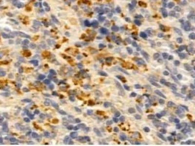 IHC-P analysis of rat spleen tissue using GTX03810 CXCL1 / GRO alpha antibody. Antigen retireval : Heat mediated antigen retrieval step in citrate buffer was performed. Dilution : 1:100