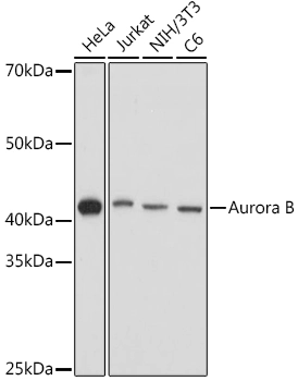 WB analysis of various lysates using GTX03922 Aurora B antibody. Loading : 25 microg Dilution : 1:1000
