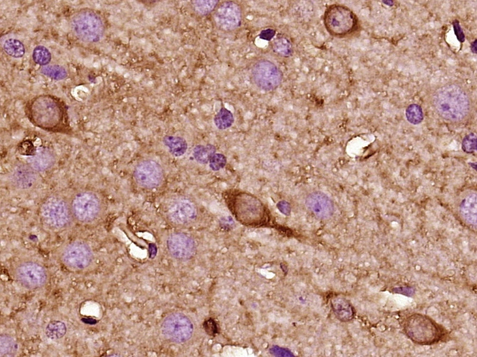 IHC-P analysis of rat brain tissue using GTX04074 Kiss1 antibody. Antigen retrieval : Boiled in sodium citrate buffer (pH 6.0) 15 min Dilution : 1:400
