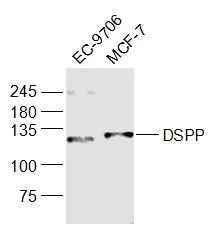 WB analysis of various cell lysates using GTX04076 DSPP antibody. Dilution : 1:1000